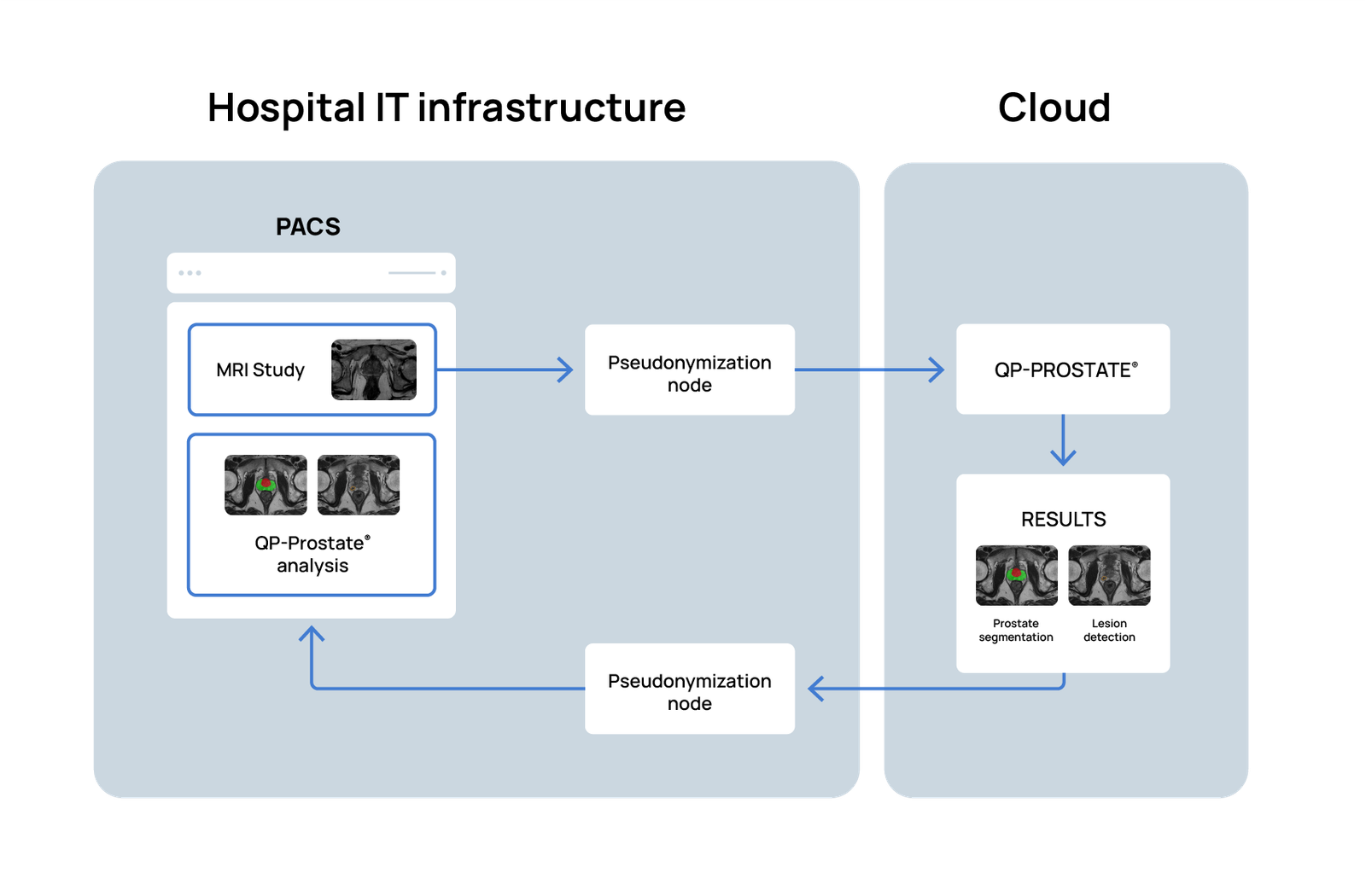 suspicious lesion on prostate