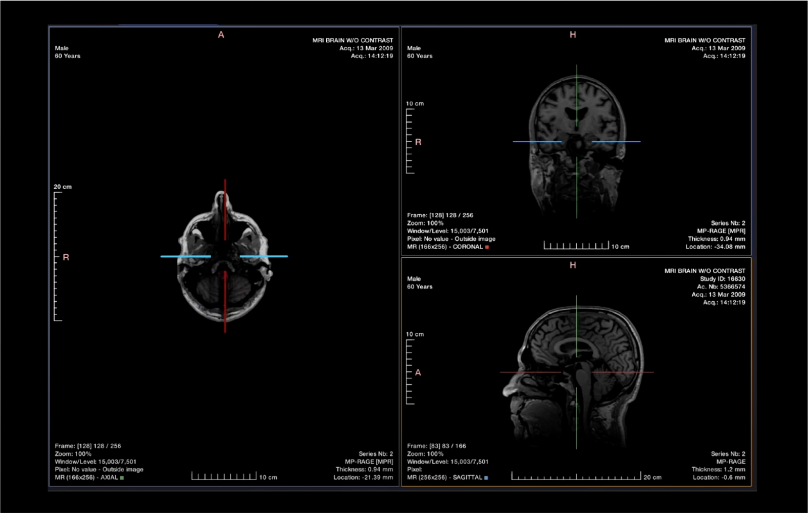 AI diagnostic imaging 