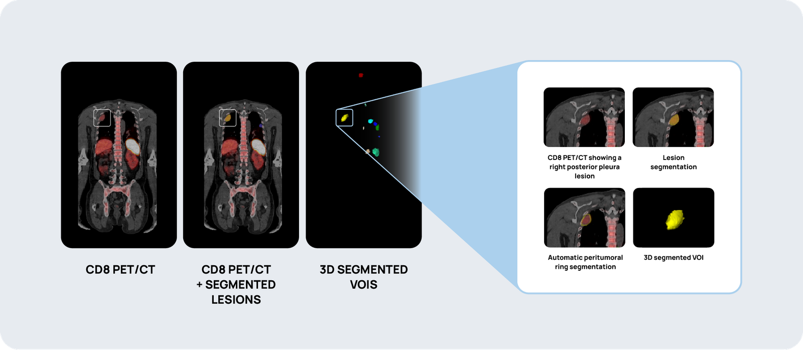 241205_Inmune PET_Diagram