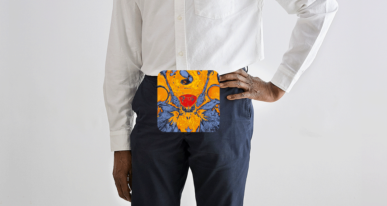 feature_prostate_2025