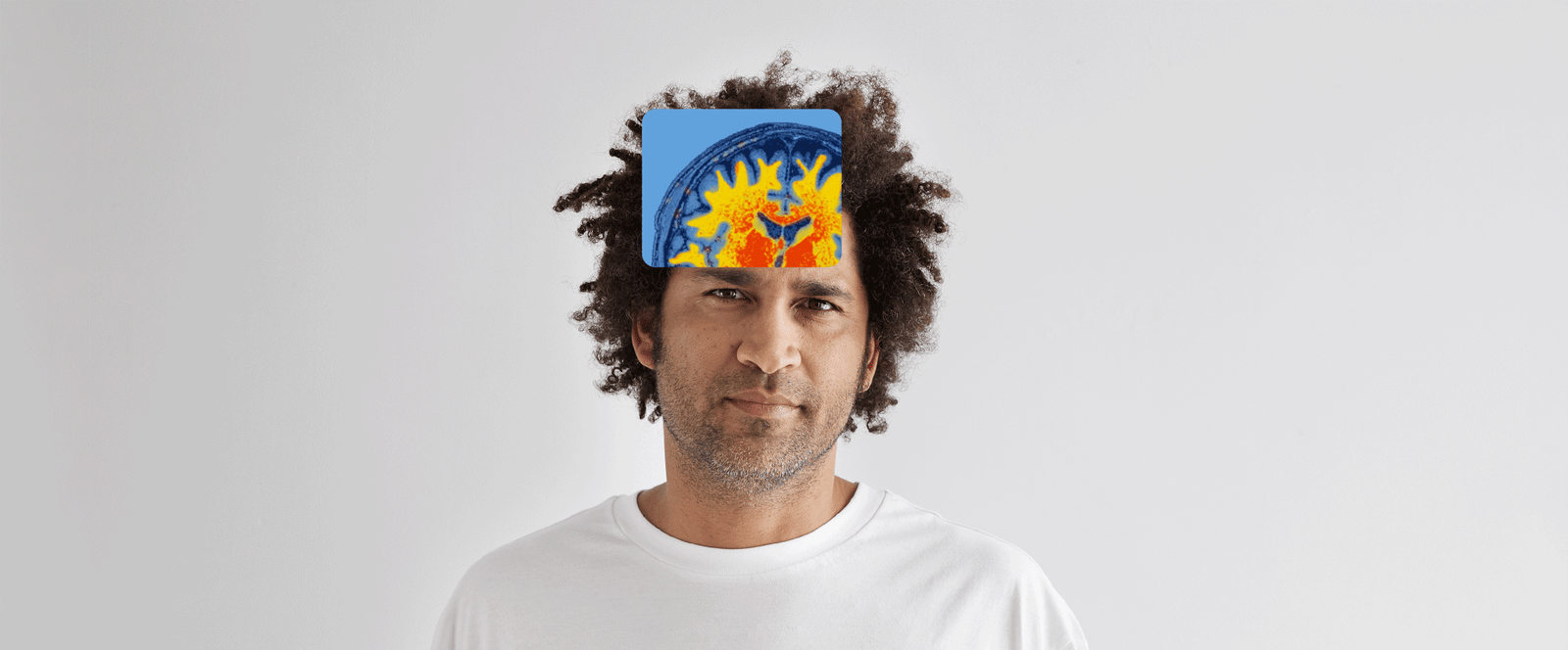 quibim_hero_brain2_2024