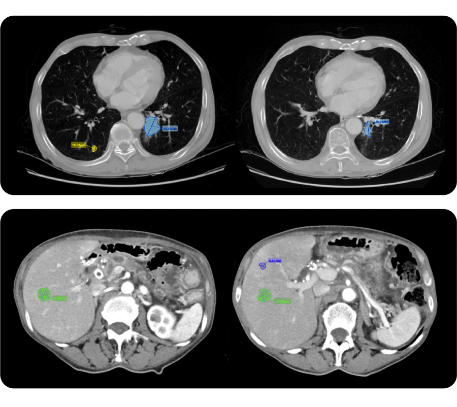 AI-supported-lesion-assessment-tool