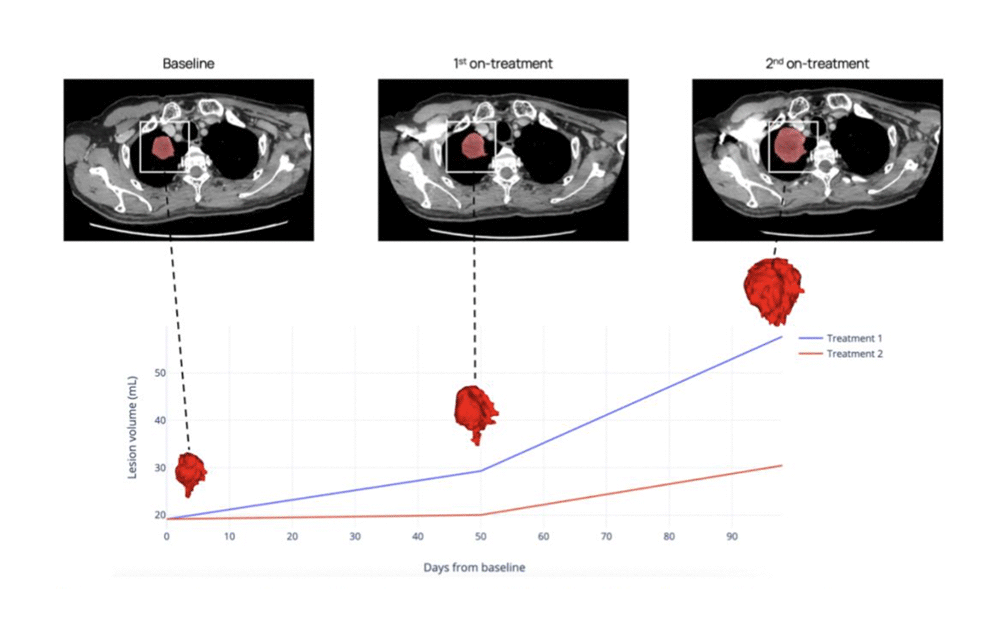 Tumor-growth-kinetics