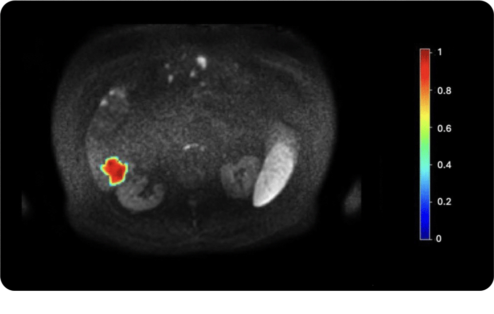 Tumor-heterogeneity-assessment
