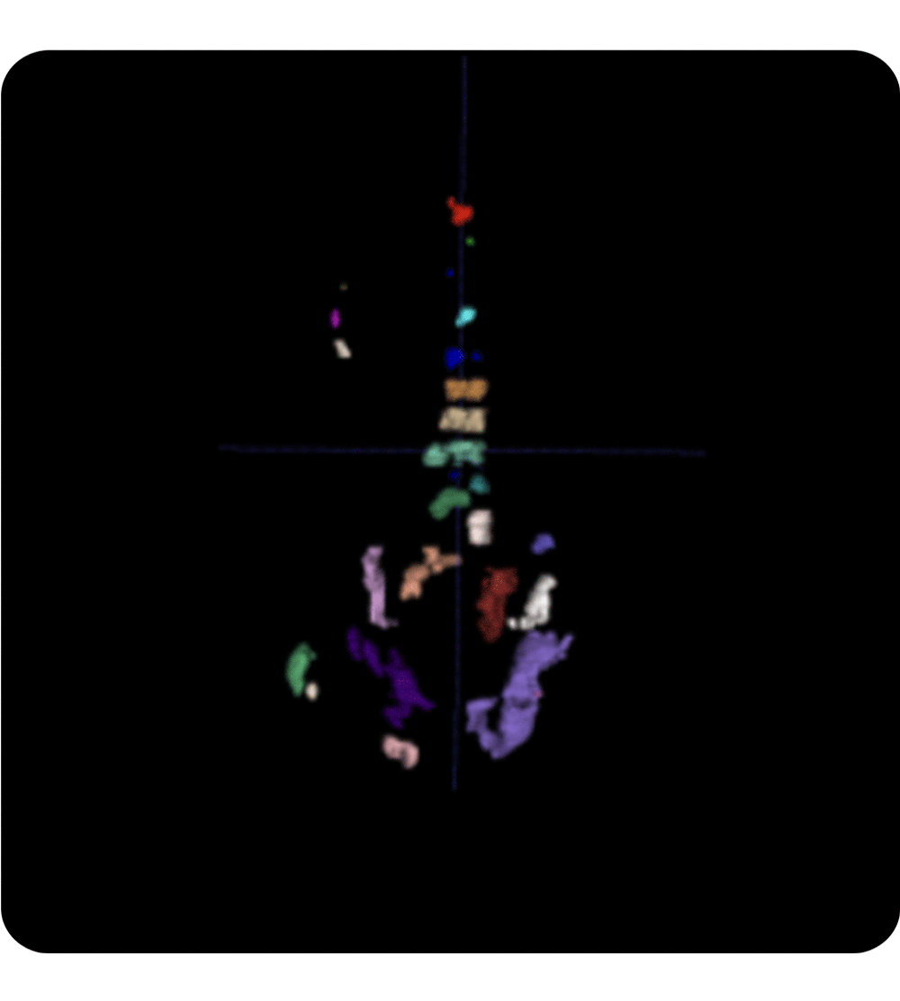 Whole-body-tumor-burden-assessment