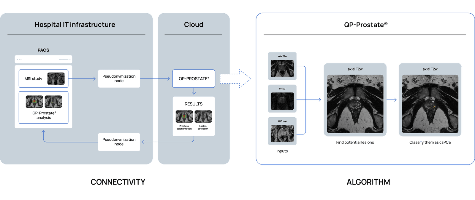 quibim-diagram-prostate-1